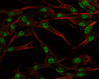 Anti-SOX3 antibody used in Immunocytochemistry/ Immunofluorescence (ICC/IF). GTX129235