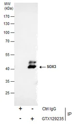 Anti-SOX3 antibody used in Immunoprecipitation (IP). GTX129235