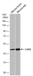 Anti-LHX2 antibody used in Western Blot (WB). GTX129241