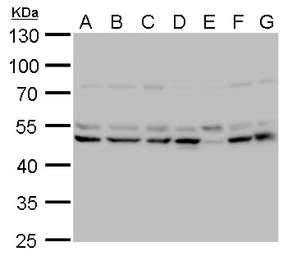 Anti-LHX2 antibody used in Western Blot (WB). GTX129241