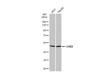 Anti-LHX2 antibody used in Western Blot (WB). GTX129241