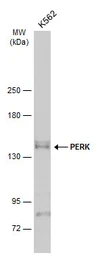 Anti-PERK antibody used in Western Blot (WB). GTX129275