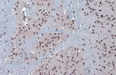 Anti-PERK antibody used in IHC (Paraffin sections) (IHC-P). GTX129275