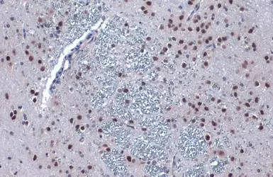 Anti-PERK antibody used in IHC (Paraffin sections) (IHC-P). GTX129275