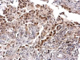 Anti-TRPS1 antibody used in IHC (Paraffin sections) (IHC-P). GTX129429