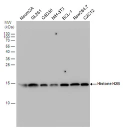 Anti-Histone H2B antibody used in Western Blot (WB). GTX129434