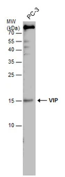 Anti-VIP antibody used in Western Blot (WB). GTX129461