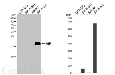 Anti-VIP antibody used in Western Blot (WB). GTX129461