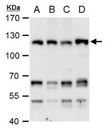 Anti-CHD1L antibody used in Western Blot (WB). GTX129527