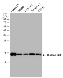 Anti-Histone H2B antibody used in Western Blot (WB). GTX129565