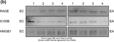 Anti-S100 beta antibody used in Western Blot (WB). GTX129573