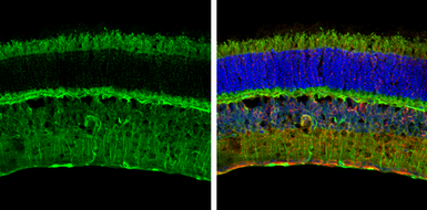 Anti-S100 beta antibody used in IHC (Frozen sections) (IHC-Fr). GTX129573