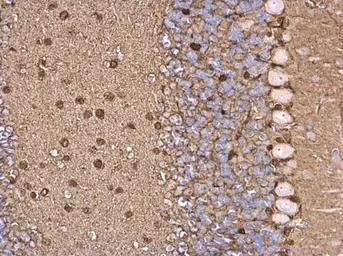 Anti-S100 beta antibody used in IHC (Paraffin sections) (IHC-P). GTX129573