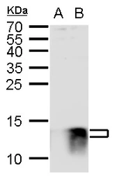 Anti-S100 beta antibody used in Western Blot (WB). GTX129573