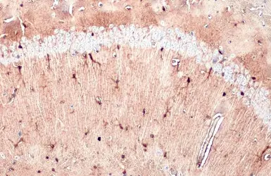 Anti-S100 beta antibody used in IHC (Paraffin sections) (IHC-P). GTX129573