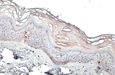 Anti-S100 beta antibody used in IHC (Paraffin sections) (IHC-P). GTX129573