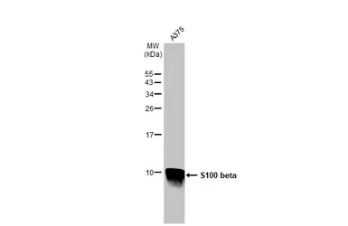 Anti-S100 beta antibody used in Western Blot (WB). GTX129573