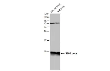 Anti-S100 beta antibody used in Western Blot (WB). GTX129573