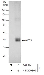 Anti-MCT1 antibody used in Immunoprecipitation (IP). GTX129599