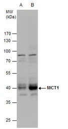 Anti-MCT1 antibody used in Western Blot (WB). GTX129599