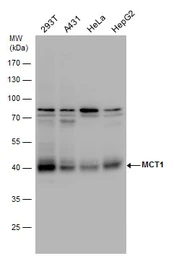 Anti-MCT1 antibody used in Western Blot (WB). GTX129599