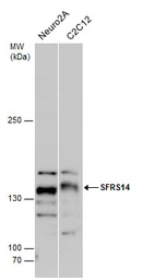 Anti-SFRS14 antibody used in Western Blot (WB). GTX129798