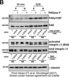 Anti-FAK (phospho Tyr397) antibody used in Western Blot (WB). GTX129840