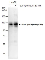 Anti-FAK (phospho Tyr397) antibody used in Western Blot (WB). GTX129840