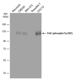 Anti-FAK (phospho Tyr397) antibody used in Western Blot (WB). GTX129840