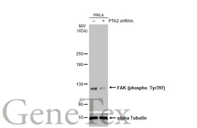 Anti-FAK (phospho Tyr397) antibody used in Western Blot (WB). GTX129840