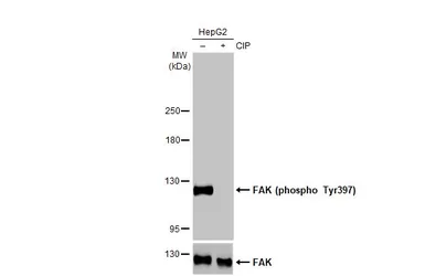 Anti-FAK (phospho Tyr397) antibody used in Western Blot (WB). GTX129840