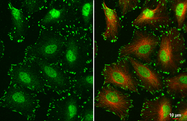 Anti-FAK (phospho Tyr397) antibody used in Immunocytochemistry/ Immunofluorescence (ICC/IF). GTX129840