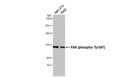 Anti-FAK (phospho Tyr397) antibody used in Western Blot (WB). GTX129840