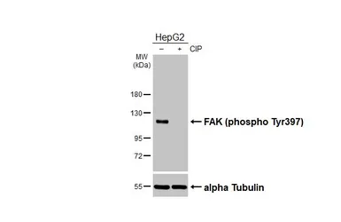 Anti-FAK (phospho Tyr397) antibody used in Western Blot (WB). GTX129840