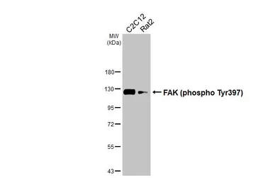 Anti-FAK (phospho Tyr397) antibody used in Western Blot (WB). GTX129840