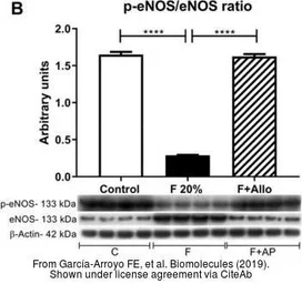 Anti-eNOS antibody used in Western Blot (WB). GTX129843