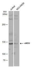 Anti-eNOS antibody used in Western Blot (WB). GTX129843