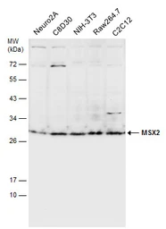 Anti-MSX2 antibody used in Western Blot (WB). GTX129870