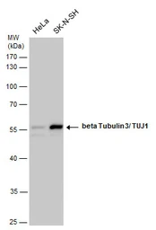 Anti-beta Tubulin 3/ Tuj1 antibody used in Western Blot (WB). GTX129913