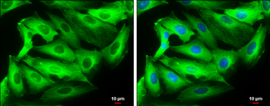 Anti-beta Tubulin 3/ Tuj1 antibody used in Immunocytochemistry/ Immunofluorescence (ICC/IF). GTX129913