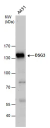 Anti-Desmoglein 3 antibody used in Western Blot (WB). GTX129931