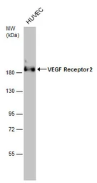 Anti-VEGF Receptor 2 antibody used in Western Blot (WB). GTX129943