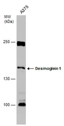 Anti-Desmoglein 1 antibody used in Western Blot (WB). GTX129983