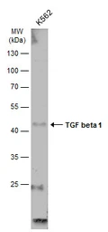 Anti-TGF beta 1 antibody used in Western Blot (WB). GTX130023