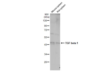 Anti-TGF beta 1 antibody used in Western Blot (WB). GTX130023