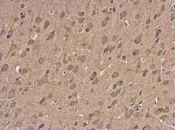 Anti-NMDAR2B antibody used in IHC (Paraffin sections) (IHC-P). GTX130184