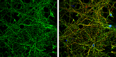 Anti-NMDAR2B antibody used in Immunocytochemistry/ Immunofluorescence (ICC/IF). GTX130184