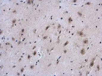 Anti-COL4A1 antibody used in IHC (Paraffin sections) (IHC-P). GTX130215