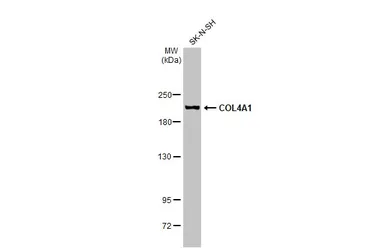 Anti-COL4A1 antibody used in Western Blot (WB). GTX130215