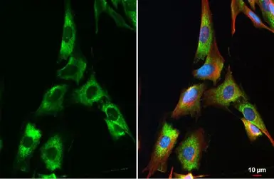 Anti-COL4A1 antibody used in Immunocytochemistry/ Immunofluorescence (ICC/IF). GTX130215